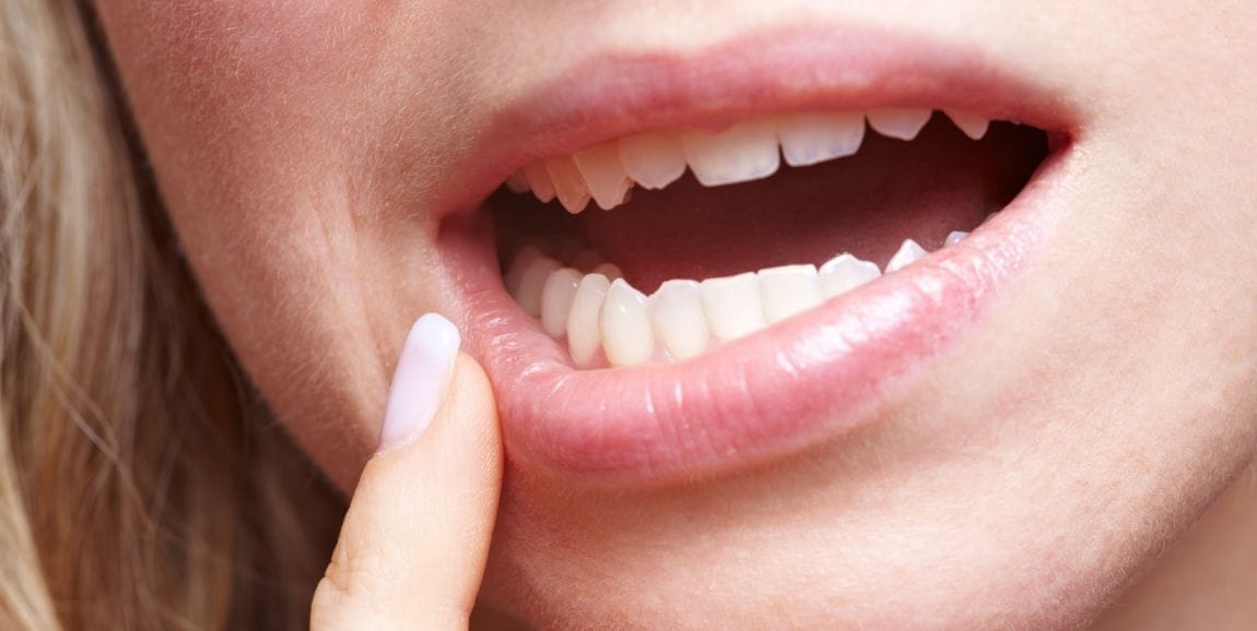 Estrazione dente a Milano