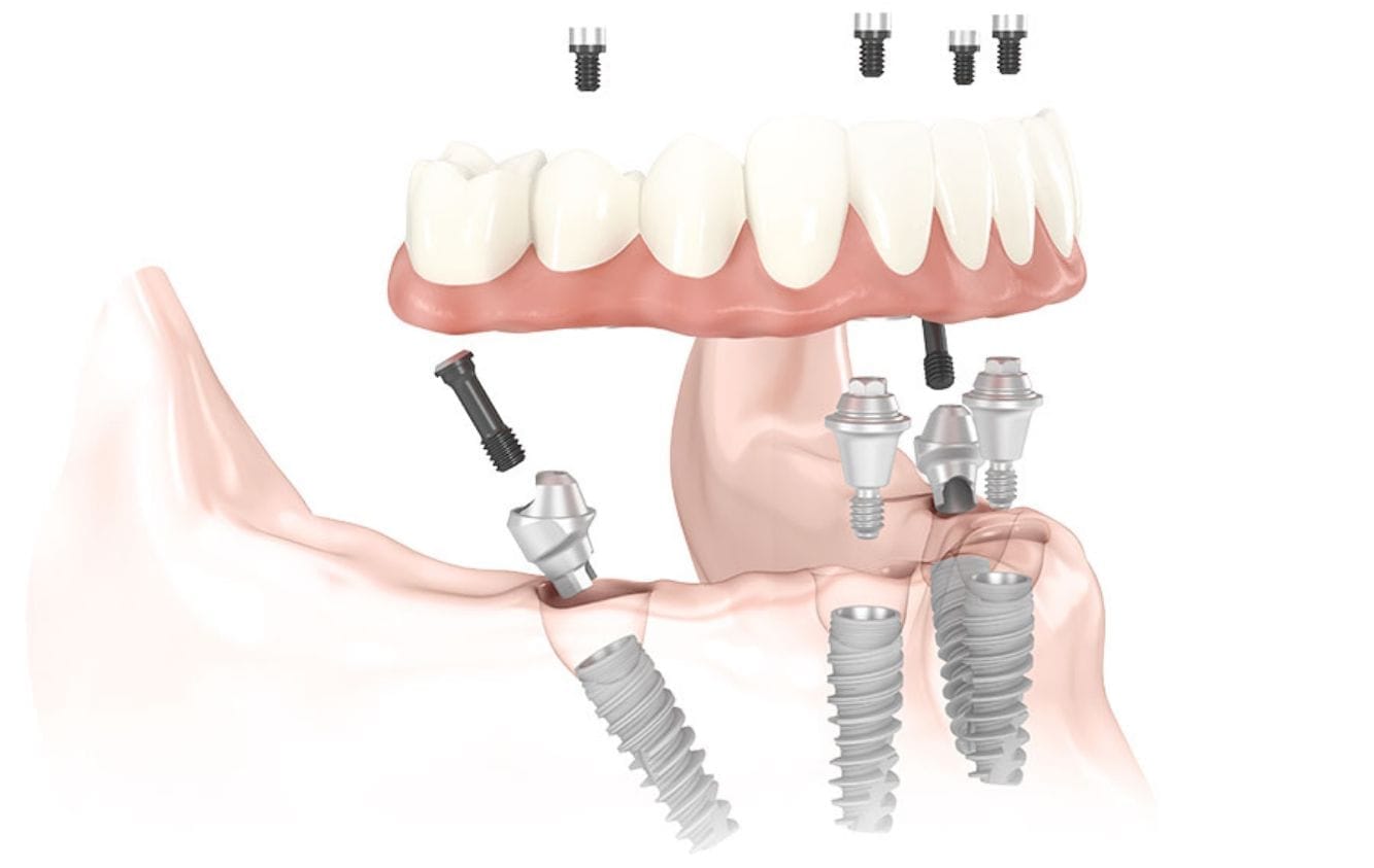 Clinica-Odontoiatrica-Mancini-all on four