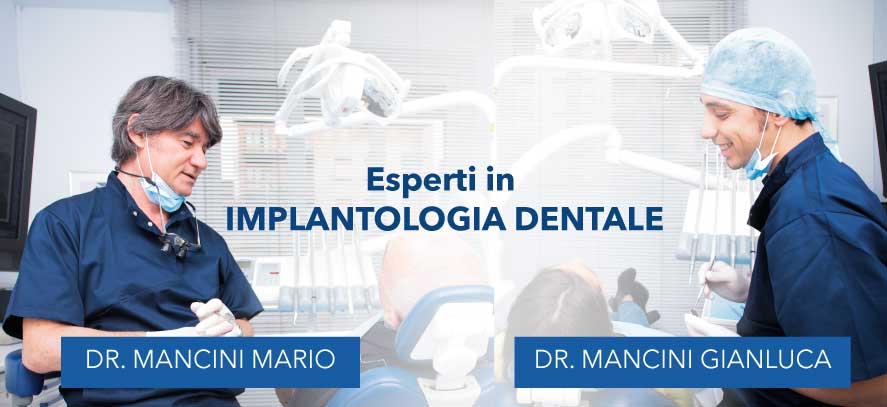 impianto-dentale-4