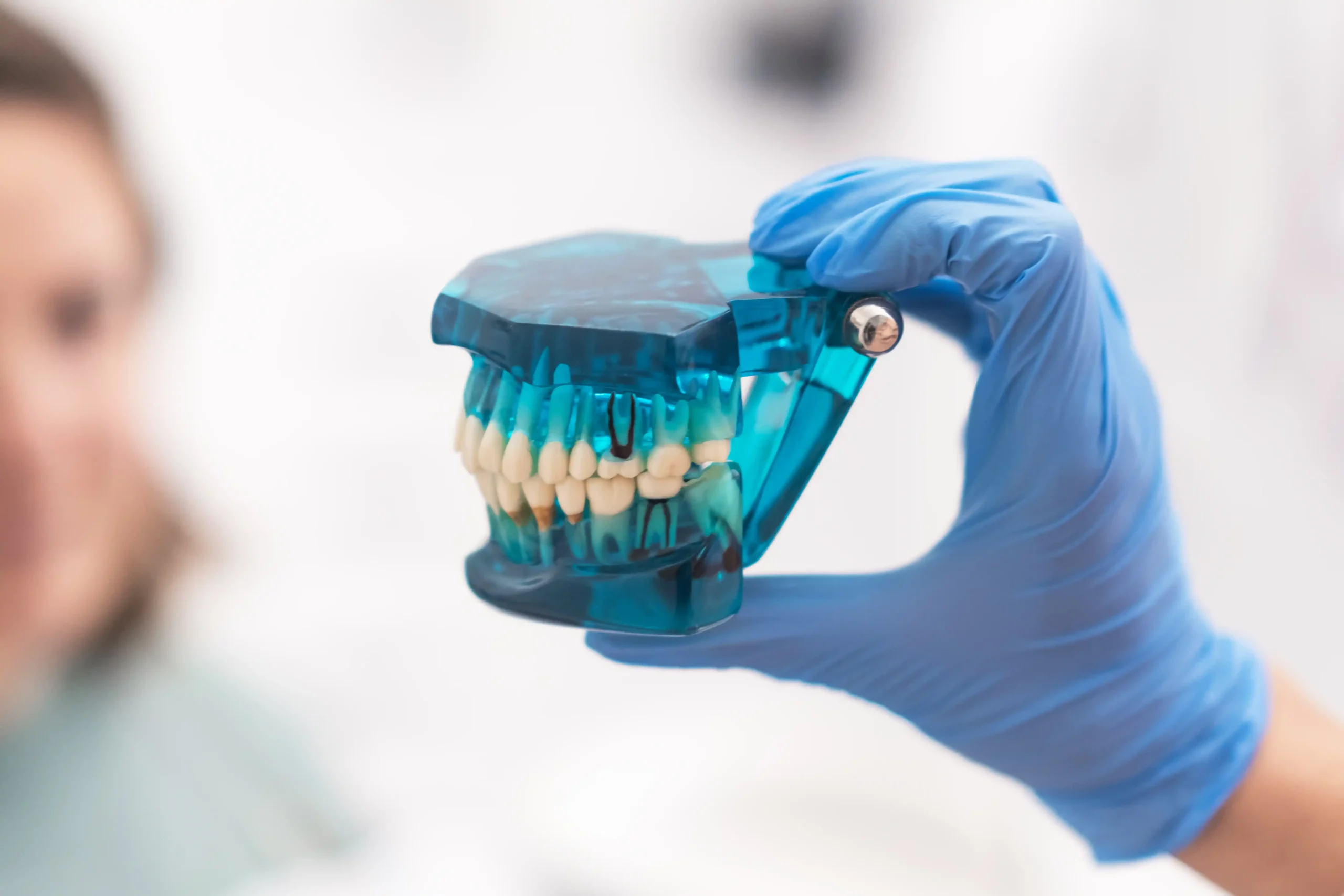impianti dentali per tutta la vita