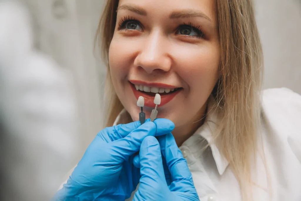limare i denti per faccette
